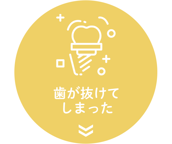 インプラント