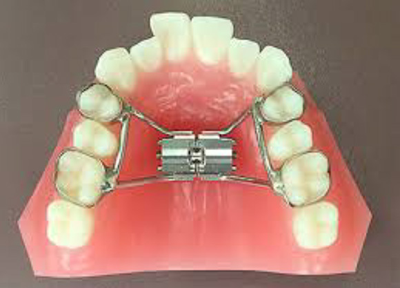 固定式拡大装置