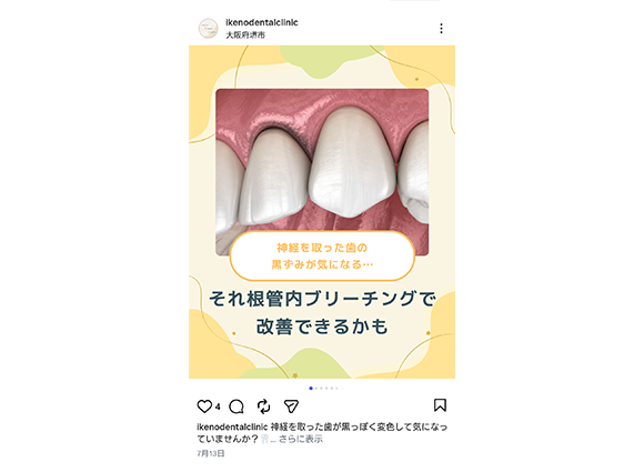 Instagramリニューアルしました！