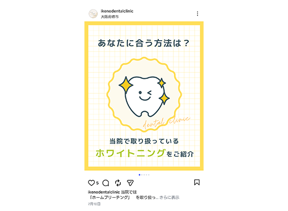 Instagramリニューアルしました！