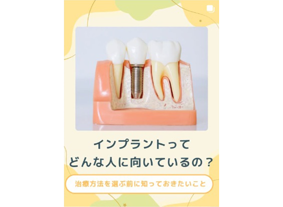 Instagramリニューアルしました！
